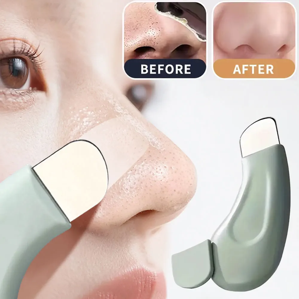 Инструмент для удаления черных – обзор и цена Nasal Aspirator